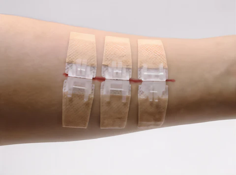Refill Kits